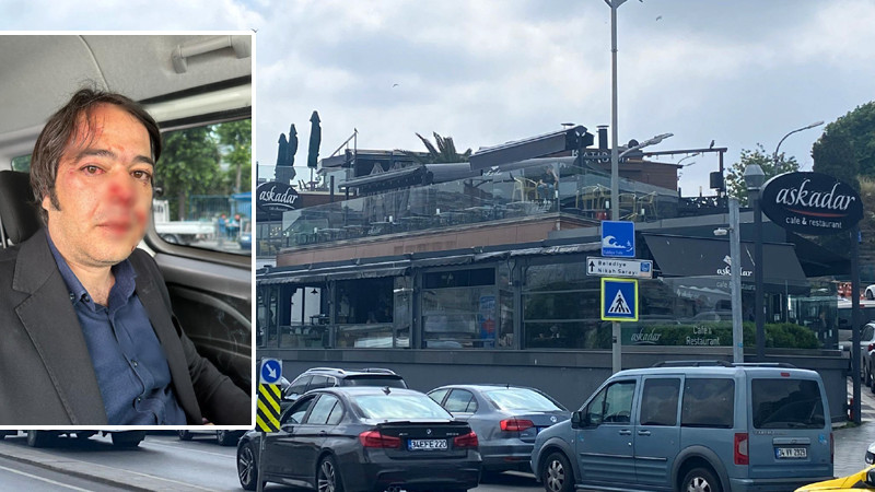 İstanbul Büyükşehir Belediyesi Ekiplerine Saldırı