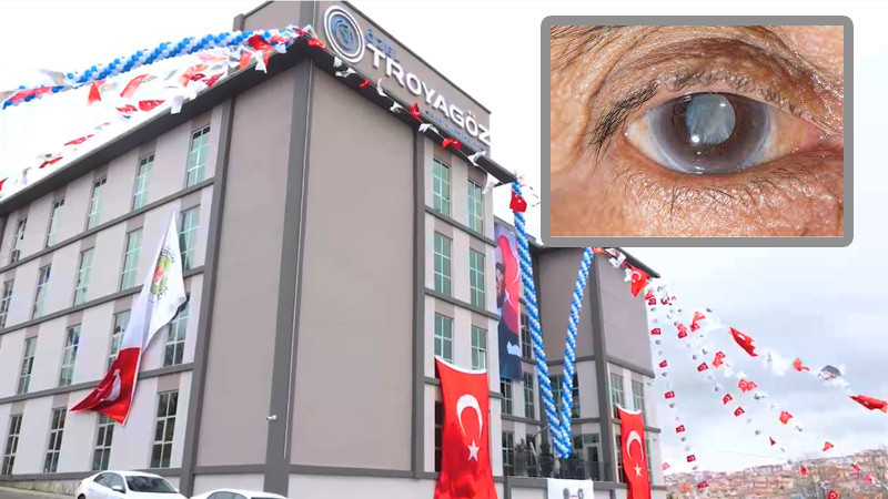 Etimesgutlulara Katarakt Göz Ameliyatı 3 Ay Ücretsiz