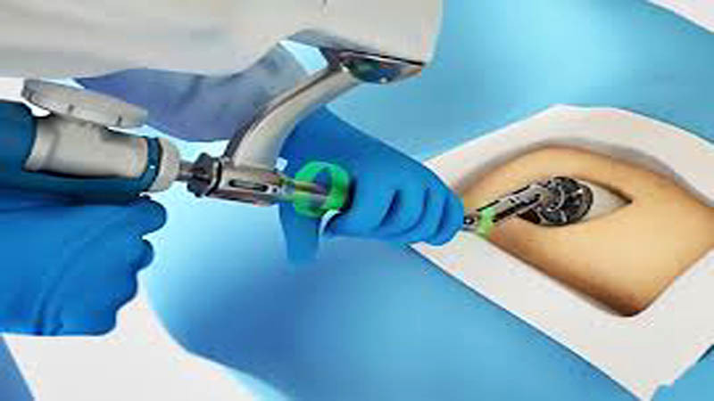 Robotik Kalça Protezi Sonrası Kaç Günde Yürünür? Doç. Dr. Ata Can Cevapladı